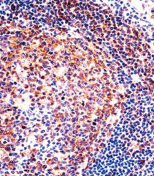 PTGIR / IP Receptor Antibody (aa210-238)