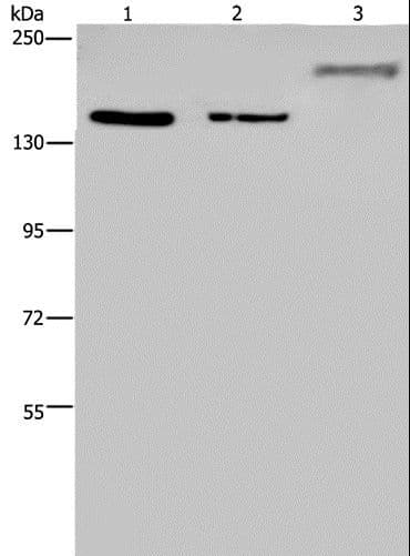 Polyclonal Rabbit anti-Human KDM3B / JMJD1B Antibody (IHC, WB)