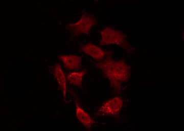 Polyclonal Rabbit anti-Human GSK3B / GSK3 Beta Antibody (IHC, IF, WB)