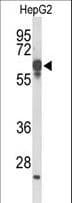 FBXL5 / FBL5 Antibody (aa86-115)