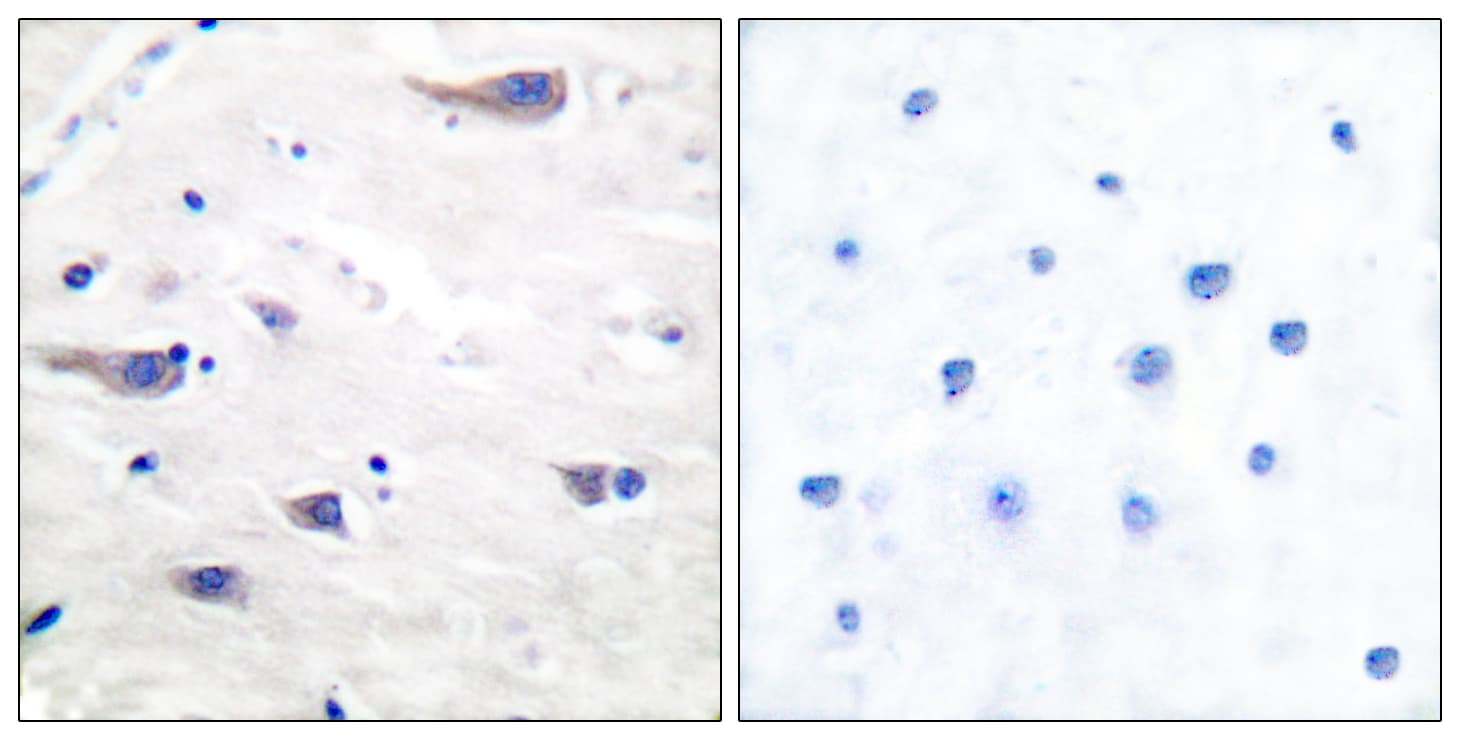 PDGFRB / PDGFR Beta Antibody (aa718-767)