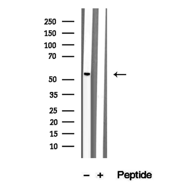 Polyclonal Rabbit anti-Human STAU1 / Staufen Antibody (IHC, IF, WB)