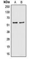 ALDH2 Antibody (N-Terminus)