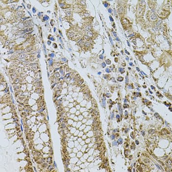 SELP / P-Selectin / CD62P Antibody