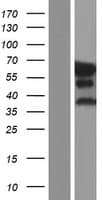 EPN2 Protein (Over-Expression Lysate Myc-DDK (Flag))