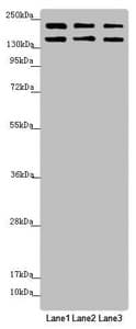 Polyclonal Rabbit anti-Human UACA Antibody (IHC, WB)