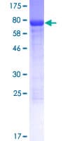Human ANKS4B Protein (Recombinant GST)