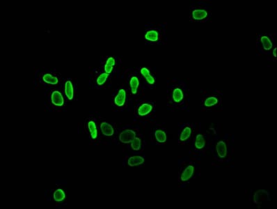 HIST1H2AI Antibody