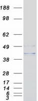 Human ASAH1 / Acid Ceramidase Protein (Recombinant Myc-DDK (Flag))