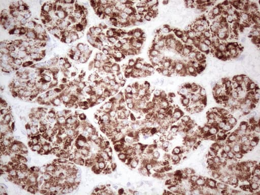 AMACR / P504S Antibody (clone OTI2E3)