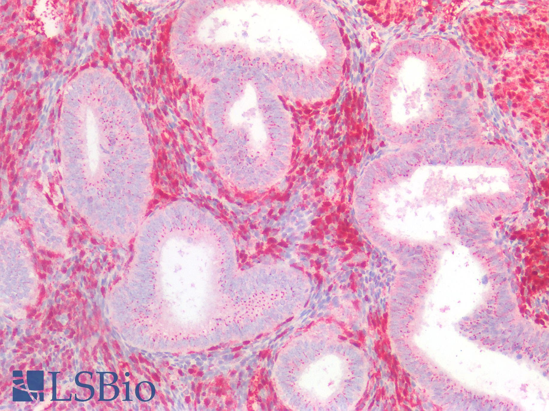 IHC-plus™ LGALS1 / Galectin 1 Antibody (aa2-135)