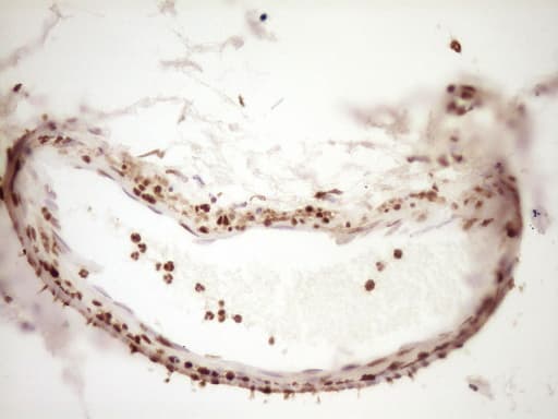 SAE1 Antibody (clone OTI6C7)