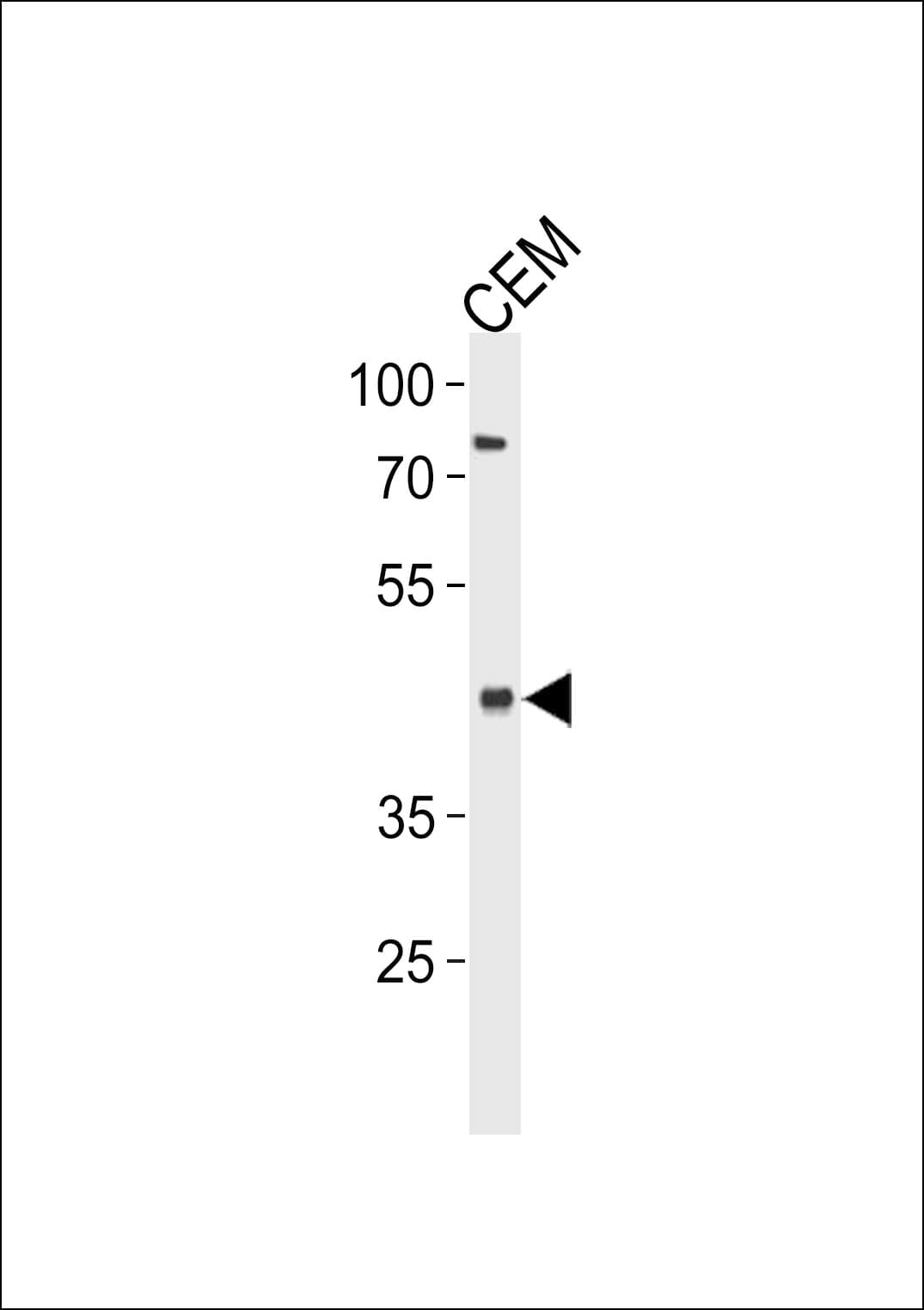 Polyclonal Rabbit anti-Human Delta-6 Desaturase / FADS2 Antibody (aa96-122, IHC, WB)