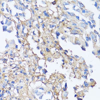 FN1 / Fibronectin Antibody