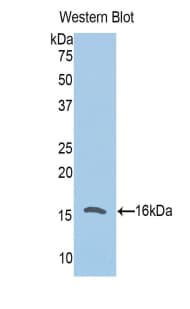 Polyclonal Rabbit anti-Mouse CFB / Complement Factor B Antibody (aa474-590, WB)
