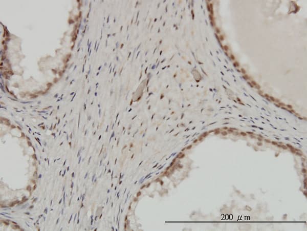 ZNF202 Antibody (clone 1E9)
