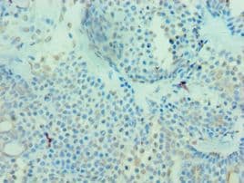 MICA Antibody (aa24-307)