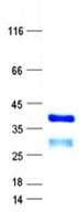 Human ETV2 Protein (Recombinant His, N-Terminal)