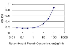 CAMK2A / CaMKII Alpha Antibody (clone 2C4)