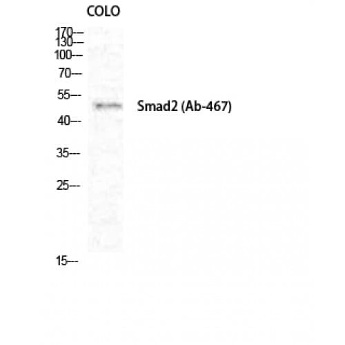 SMAD2 Antibody (410-490 aa)