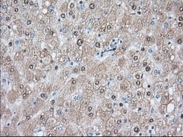 ACAT2 Antibody (clone OTI5F7)
