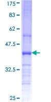 Human CHST11 Protein (Recombinant GST, N-terminus)