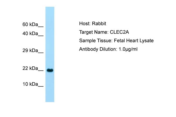Polyclonal Rabbit anti-Human CLEC2A Antibody (C-Terminus, WB)