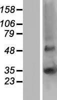 GJB5 / CX30.1 / Connexin 31.1 Protein (Over-Expression Lysate Myc-DDK (Flag))