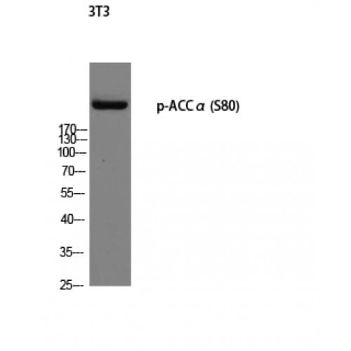 Polyclonal Rabbit anti-Human Acetyl-CoA Carboxylase / ACC Antibody (20-100 aa, IHC, WB)