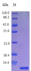 Human CCL18 / PARC Protein (Recombinant)