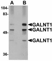 IHC-plus™ GALNT10 Antibody