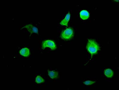 Polyclonal Rabbit anti-Human ACLP / AEBP1 Antibody (aa46-234, IHC, IF)