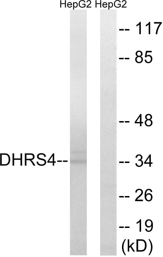 DHRS4 / PSCD Antibody