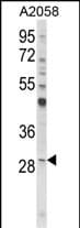 CD151 Antibody (Internal)