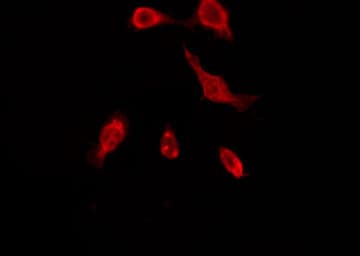 OR51A7 Antibody