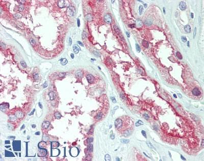 IHC-plus™ Polyclonal Rabbit anti-Human SLC1A1 / EAAT3 Antibody (IHC, IF, WB)