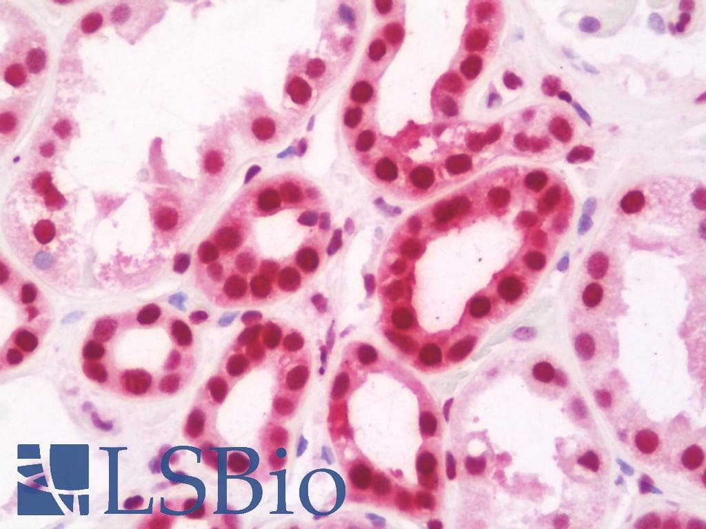 IHC-plus™ ARID1B / BAF250B Antibody (clone 2D2)
