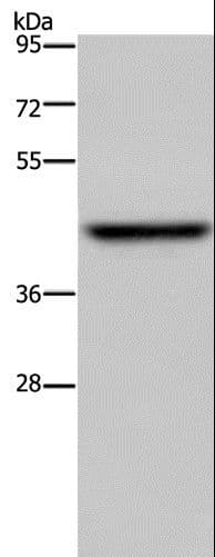 Polyclonal Rabbit anti-Human ENTPD5 / CD39L4 Antibody (IHC, WB)