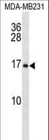 MAGP / MFAP2 Antibody (aa23-52)