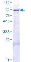 Human PKLR Protein (Recombinant GST)
