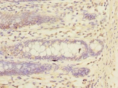 Polyclonal Rabbit anti-Human TRIM17 / RNF16 Antibody (IHC, WB)
