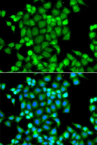 Polyclonal Rabbit anti-Human PAK2 Antibody (IHC, IF, WB)