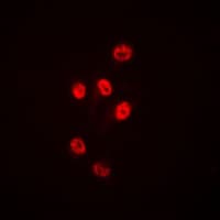 Polyclonal Rabbit anti-Human HDAC1 Antibody (C-Terminus, IHC, IF, WB)