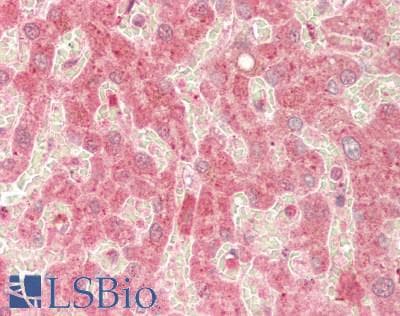 IHC-plus™ Polyclonal Goat anti-Mouse RAB14 Antibody (C-Terminus, IHC, IF, WB)