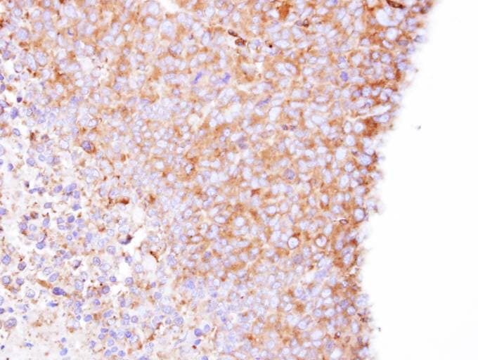 Polyclonal Rabbit anti-Human CORO1B Antibody (aa1-213, IHC, WB)
