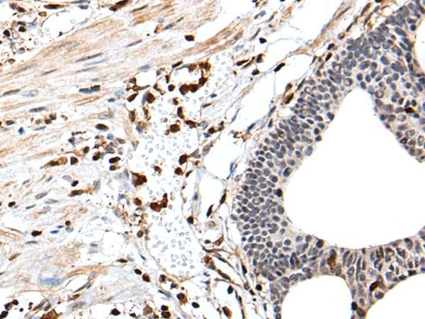 ARHGDIB / D4 GDI Antibody