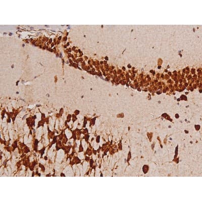 Polyclonal Rabbit anti-Human c-Kit / CD117 Antibody (IHC, IF, WB)