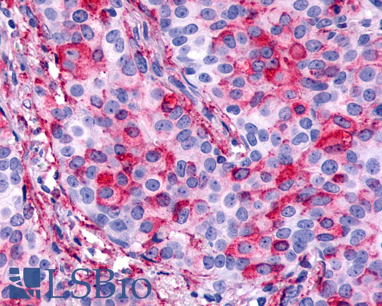 PathPlus™ CELSR1 Antibody (N-Terminus)