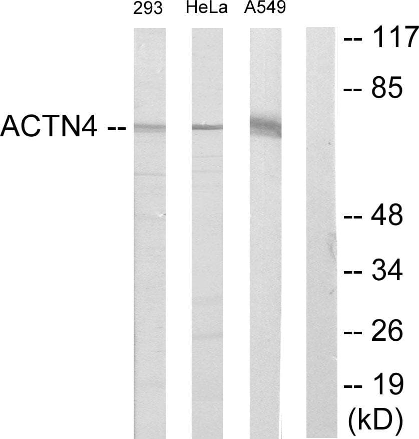 Polyclonal Rabbit anti-Human ACTN4 Antibody (WB)