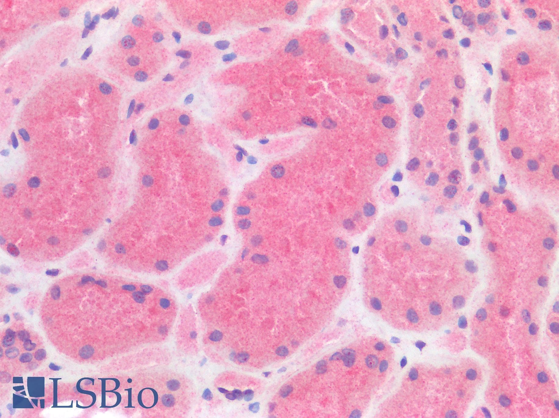 PathPlus™ BRAF / B-Raf Antibody